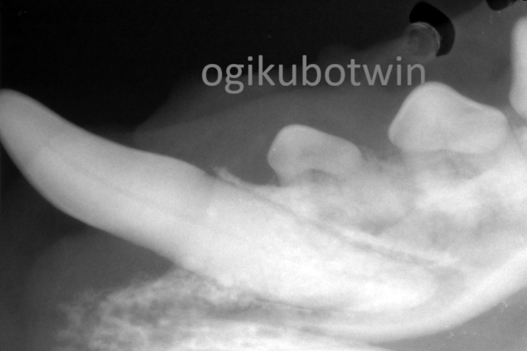 再生治療　犬歯　レントゲン